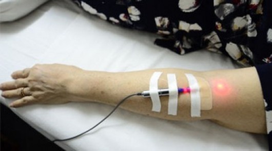 Phòng Laser Nội Mạch